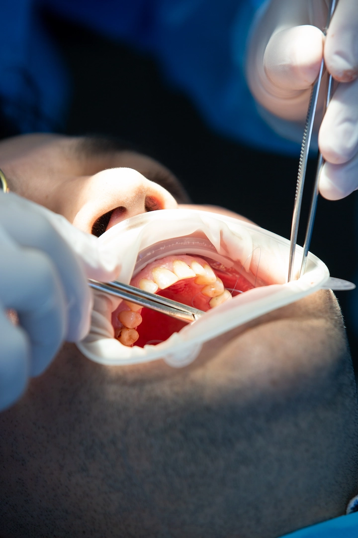 Clínica Dental Águila en Quito