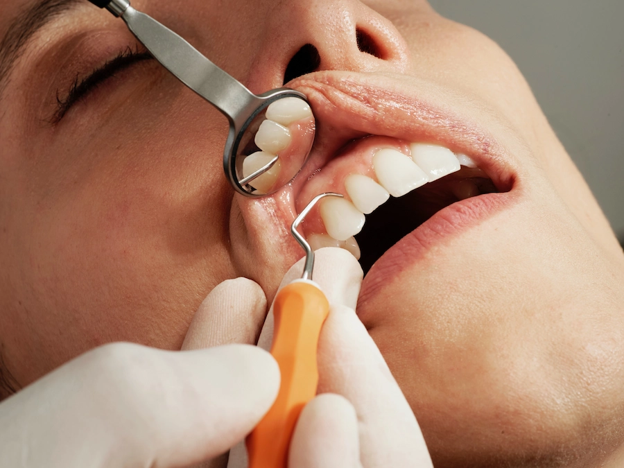 Clínica Dental Águila en Quito